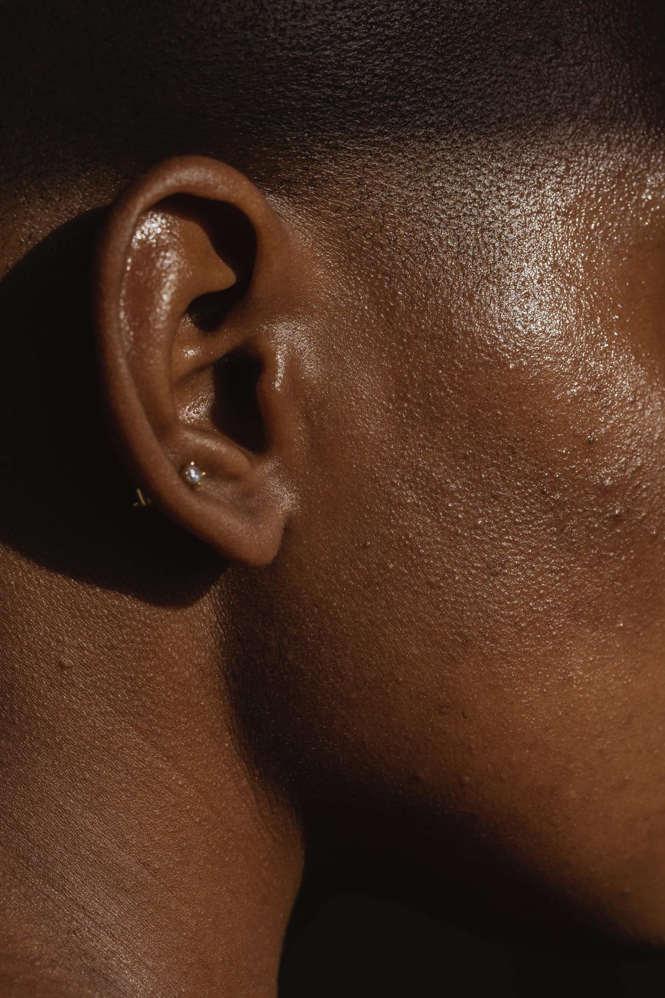 Dark Spot Removers for Sensitive Skin: What to Look For